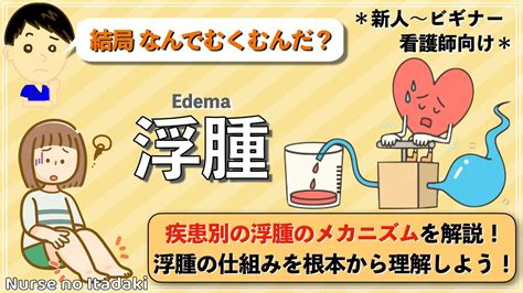 浮腫病|【医師監修】浮腫のメカニズムとは ― 浮腫の仕組み。